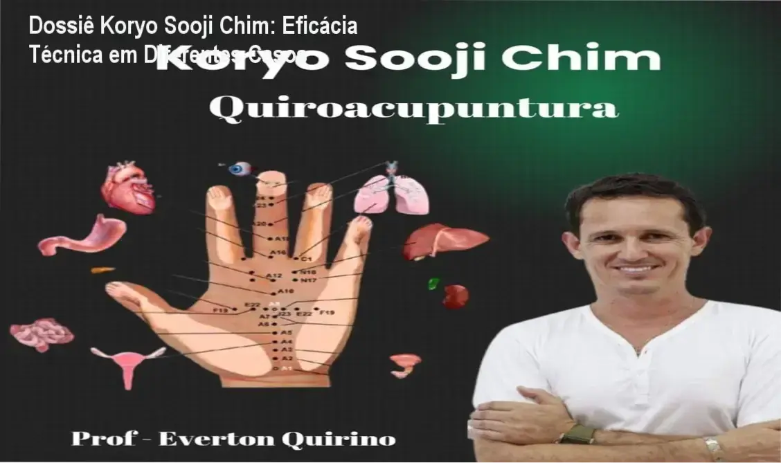 Demonstração técnica de pontos de Quiropuntura Koryo Sooji Chim na mão para tratamento de dores