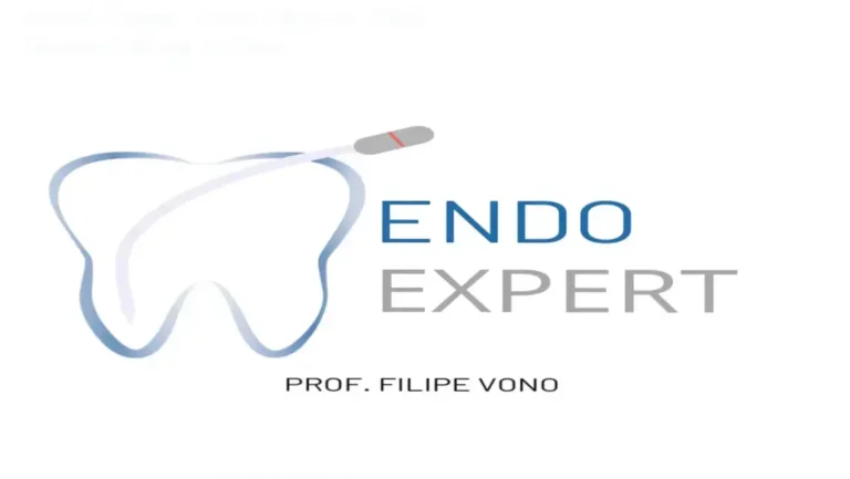 Instrumentação endodôntica com o Sistema de Limas Vono em canal curvo